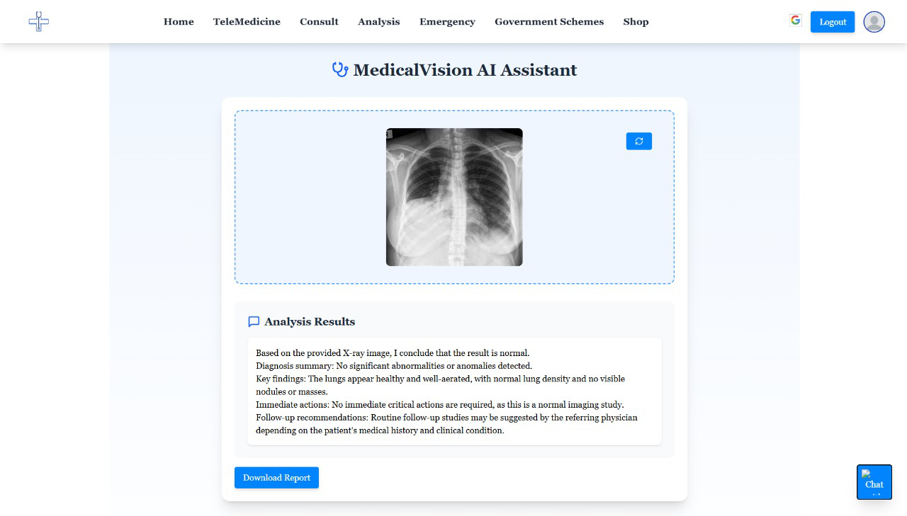 Xray Analysis